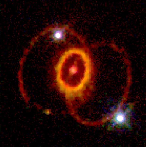 Mysterious Ring Structure Around Supernova 1987A